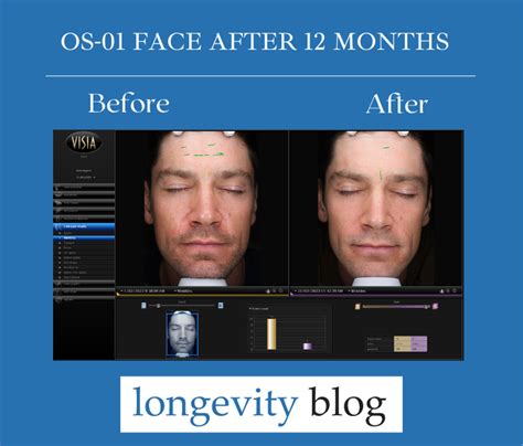 Oneskin Review Before And After With Images —