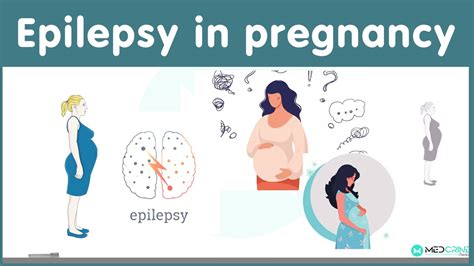 Epilepsy In Pregnancy Causes Risks And Management Youtube