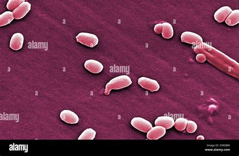 Electron Micrograph Of Spores Of Bacillus Anthracis A Gram Positive