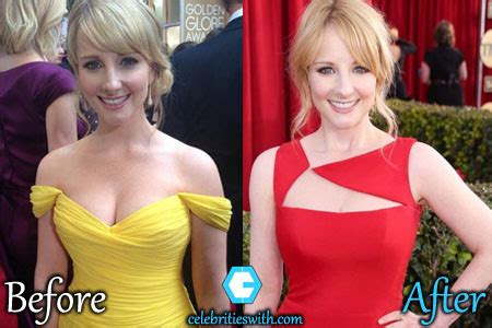 Melissa Rauch Boob Job Breast Reduction Before And After Pictures Celebritieswith Com