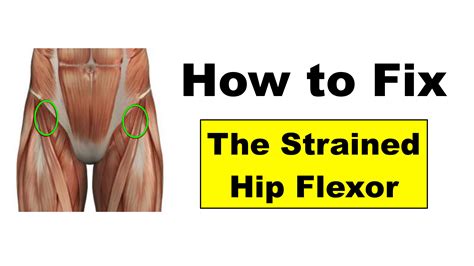 Fixing Hip Flexor Pain Squat University