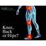 Referred Pain – Knee Back Or Hips  The Bodyworks Clinic Marbella Spain