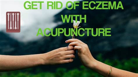 Can Acupuncture Treat Eczema Youtube