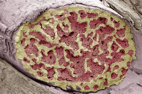 The epiphyses are made of spongy bone covered with a thin layer of compact bone. Bone Marrow: Structure, Function, Diseases and More