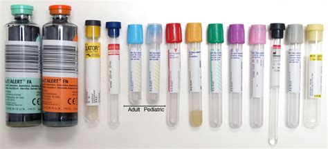 Phlebotomy How To Draw Blood With Venipuncture Hubpages