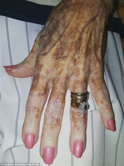 Elderly Woman With Insecurities About Her Hands Is Given A Manicure Daily Mail Online