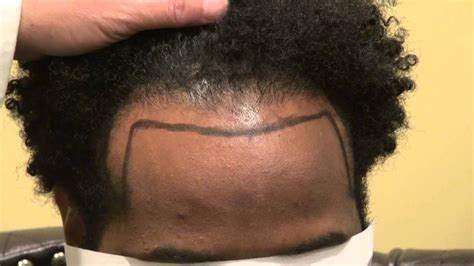 Ayurveda is an old indian ritual that has been practised for over 5,000 years which provides an holistic outlook on living a health hair. African American Bald Hair Loss Treatment Solution ...
