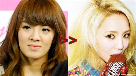 Bad Plastic Surgery Kpop These Before And After Disaster Celebrity