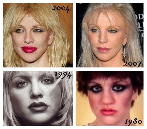 Courtney Love Nose Jobs Breast Implants Liposuction Plastic Surgery Before And After Star