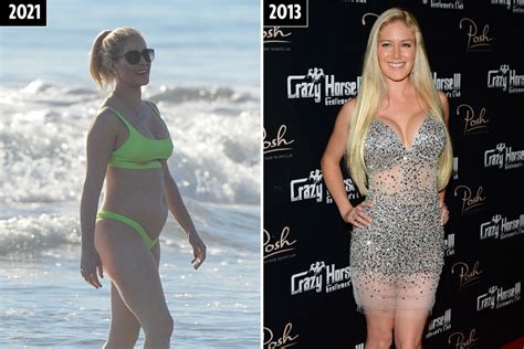 The Staggering Transformation Of The Hills Star Heidi Montag’s Body With Boob Jobs