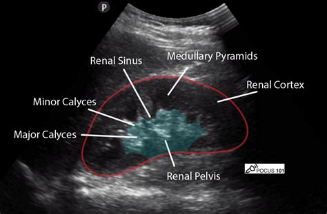 What Do The Colors Mean On A Kidney Ultrasound The Meaning Of Color