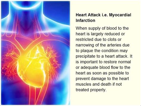 Myocardial infarction (mi) is one of the clinical forms of coronary heart disease occurring with the development of ischemic necrosis of the myocardial site, due to the absolute or relative insufficiency of its blood supply. Heart Attack i.e. Myocardial Infarction | Cardiac Arrest ...
