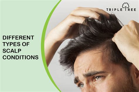 Scalp Conditions Symptoms And Causes Triple Tree