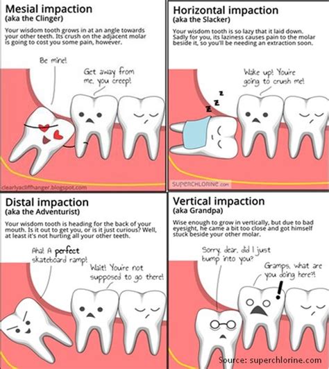View When Wisdom Teeth Grow Images Teeth Walls Collection For Everyone