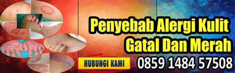 Penyebab telinga gatal yang pertama adalah ketika anda sedang menggunakan alat tertentu untuk membersihkan telinga. Penyebab Alergi Kulit Gatal Dan Merah