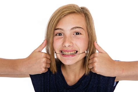 What Is Orthodontic Headgear The Village Orthodontics