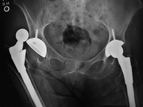 Medical Apparatus Imaging Guide Joint Arthroplasty