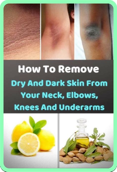 Here S How You Can Remove The Dark And Dry Skin On Your Knees Elbows
