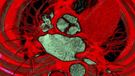 Healthy Heart 3d Ct Scan Stock Image C0492653 Science Photo Library