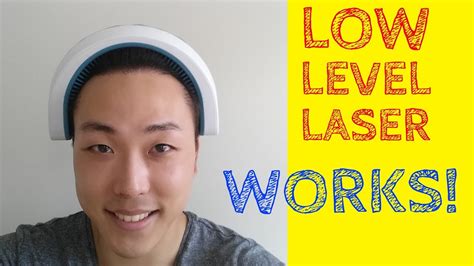 Low Level Laser Therapy Lllt For Hair Loss Really Works Youtube