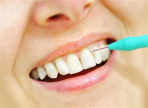 Top 8 Causes Of White Gums Around Teeth