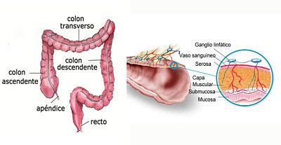It usually begins as small, noncancerous (benign) clumps of cells called polyps that form on the inside of the colon. Enfermedades del colon - Explicacion | Significado e ...
