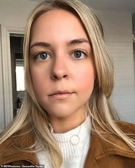 Woman 25 Is Left With A Droopy Face After Surgery To Remove A Brain