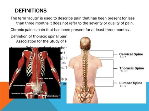 Ppt Back Pain Powerpoint Presentation Free Download Id2015884