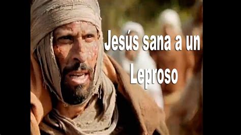 Jesús Sana A Un Leproso Por El Pastor Alberto Castro Youtube