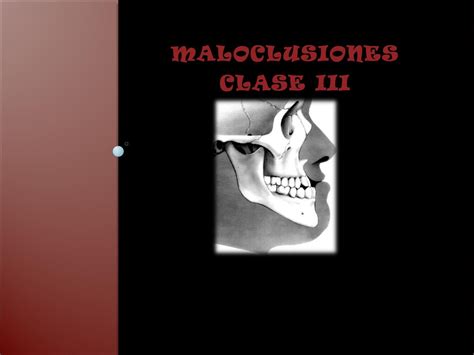 Maloclusion Clase Iii By Luis Issuu