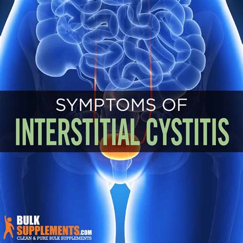Interstitial Cystitis Symptoms Causes Treatment