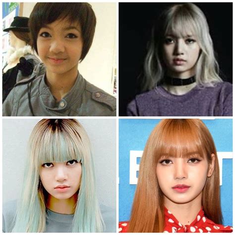 Who Had Plastic Surgery In Black Pink Quora