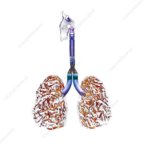 cigarette filled lungs stock image m370 1007 science photo library