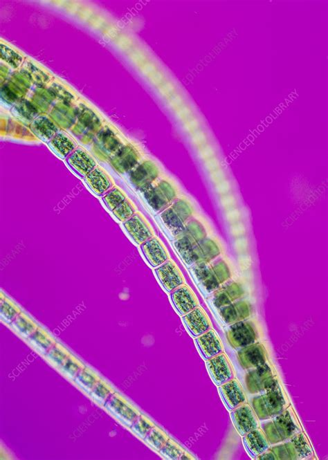 Filamentous Green Alga Ulothrix Sp Stock Image B3020150