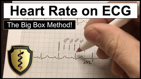 Ecg Heart Rate Calculation The Big Box Method Aka The 300 Method