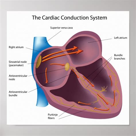 Poster Do Sistema Da Condução Do Coração Br