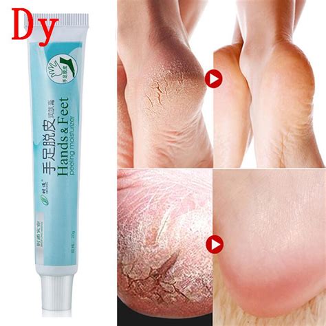 Buy Cracked Heel Balm Cream For Rough Dry And Cracked Chapped Feet Heel Skin At Affordable Prices