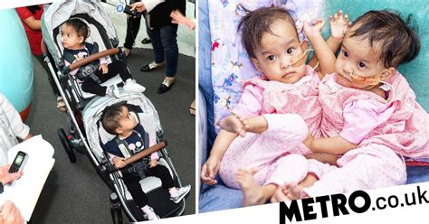 Conjoined Twins Leave Hospital After Successful Separation Surgery Metro News