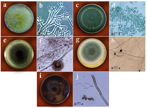 Biology Free Full Text Endophytic Fungi As Potential Biocontrol