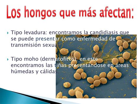 Ppt Hongos En La Salud Humana Powerpoint Presentation Free Download