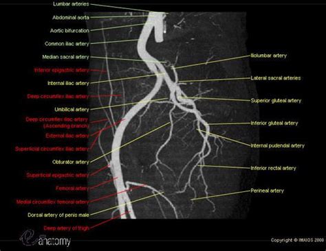 Angiogram showing the coronary arteries. Angiography (angiogram) adapted from angioCT showing all ...
