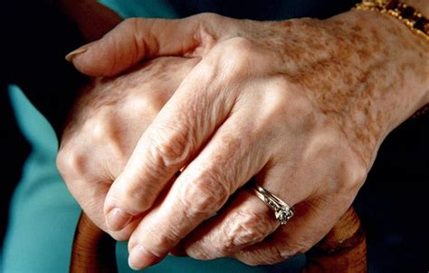5 Ways Your Hands Are Making You Look Old—and How To Erase Years Age