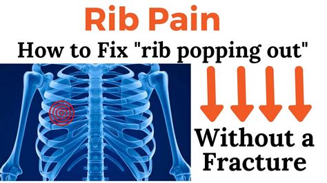 What To Do When Your Rib Pops Out Rib Pain Without A Fracture Youtube
