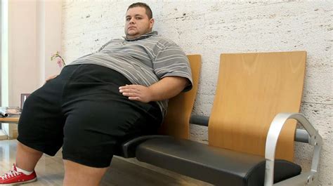 La Obesidad M Rbida En Adultos J Venes Puede Multiplicar Por El