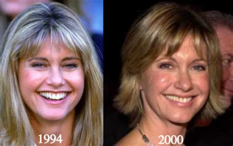 Olivia Newton John Plastic Surgery Before And After Photos Latest