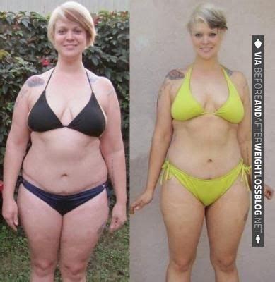 Pin On Before And After Weight Loss Surgery