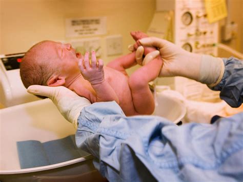 Circumcision Rates Declining In Us Infants Raising Health Risks