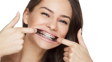Orthodontics For Adults Elite Orthodontics