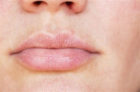 Bumps On Lips 9 Causes Home Remedies And Prevention T