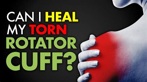 A doctor will usually recommend conservative methods over surgical treatment. Can I heal my torn ROTATOR CUFF? - YouTube